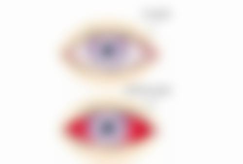 临床实例分享