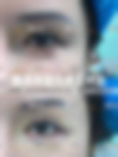 价格透明与优惠活动:高性价比之选