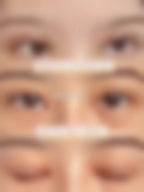 诊疗特色总结韩国MGTY整形外科