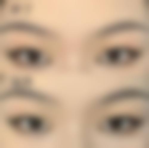 擅长项目详解:朴智恩的精细诊疗