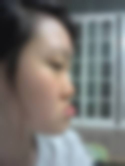 诊疗特色总结:北京维尔口腔医院(方庄分院)刘颖臻