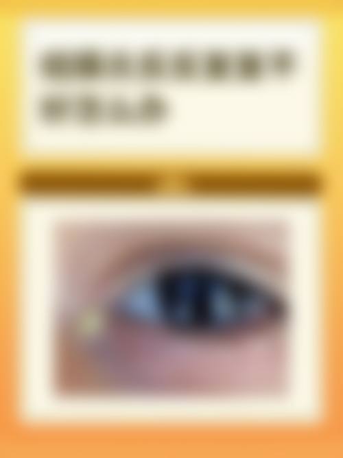 常见问题解答FAQ