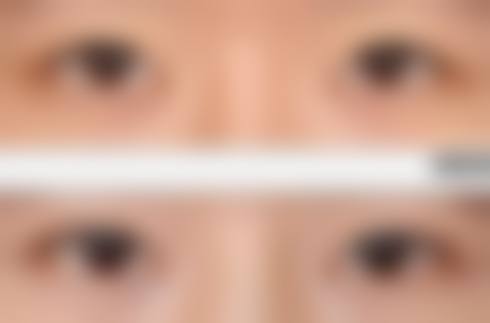 患者真实评价