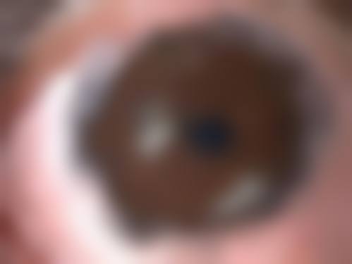 擅长项目详解:全方面覆盖眼科需求