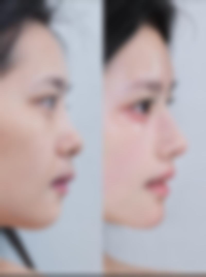 FAQ韩国MGTY整形外科