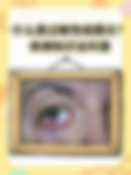FAQ:常见问题解答