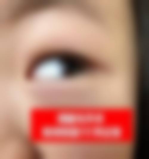 FAQ：关于济宁爱尔眼科医院安国兰