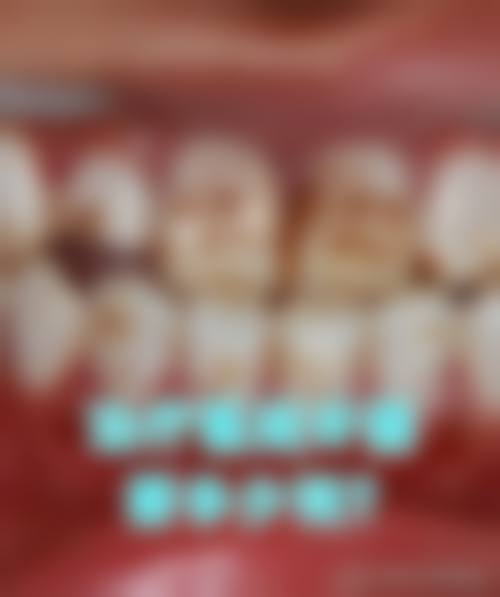 临床实例分享蒋翠玉医生靠谱吗