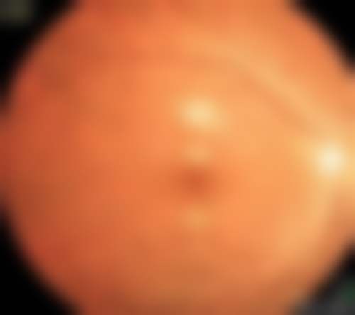 诊疗特色总结:陆蓓医生的技术与服务理念