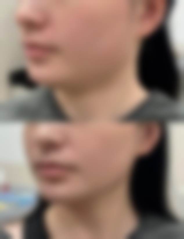 总结与预约号召
