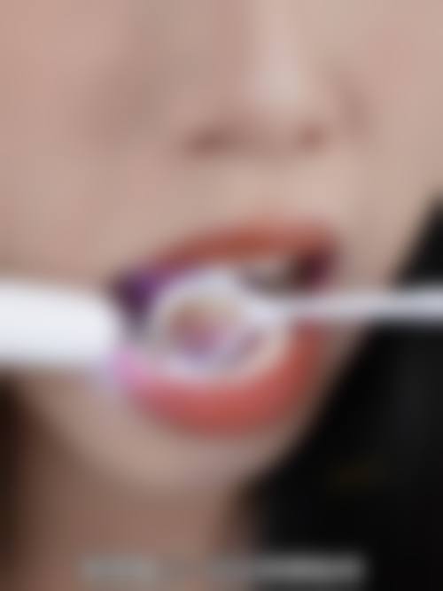 临床实例分享:深圳美奥口腔医院周芷桐