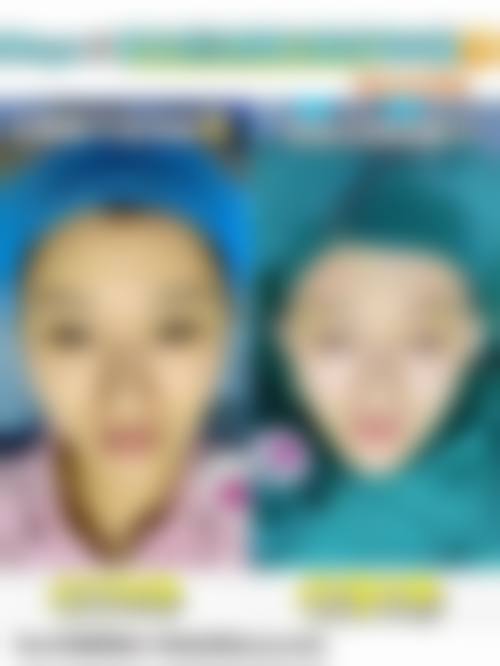 总结与预约建议