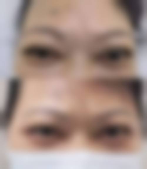 临床实例分享