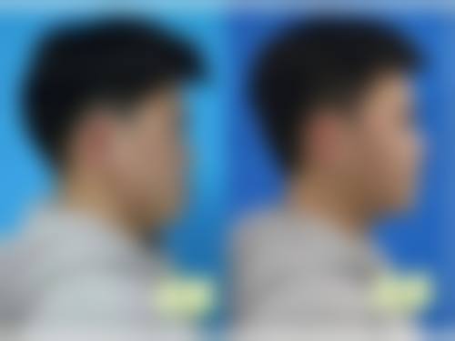 FAQ:常见问题解答