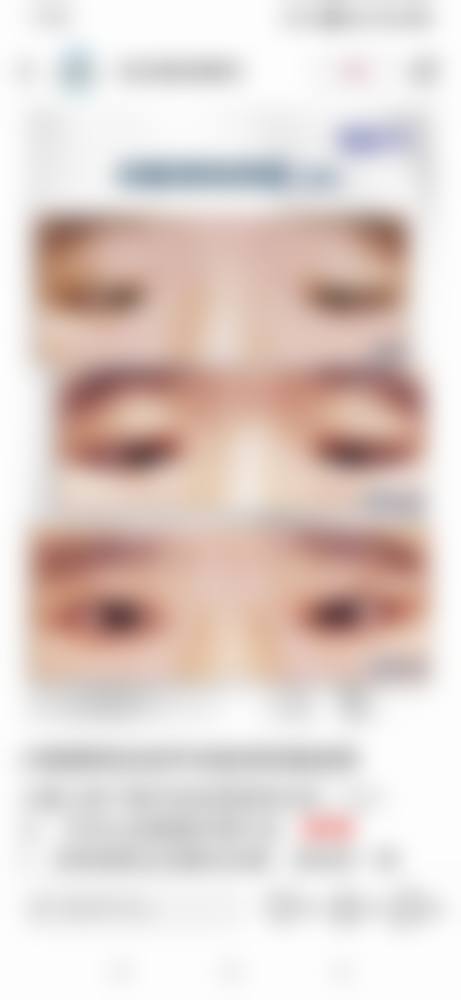 预约优惠活动:限时补贴助力复明