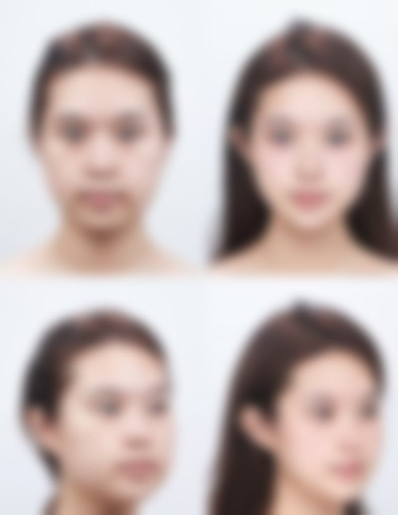 特色项目与技术优势:个性化方案解决多元美学需求